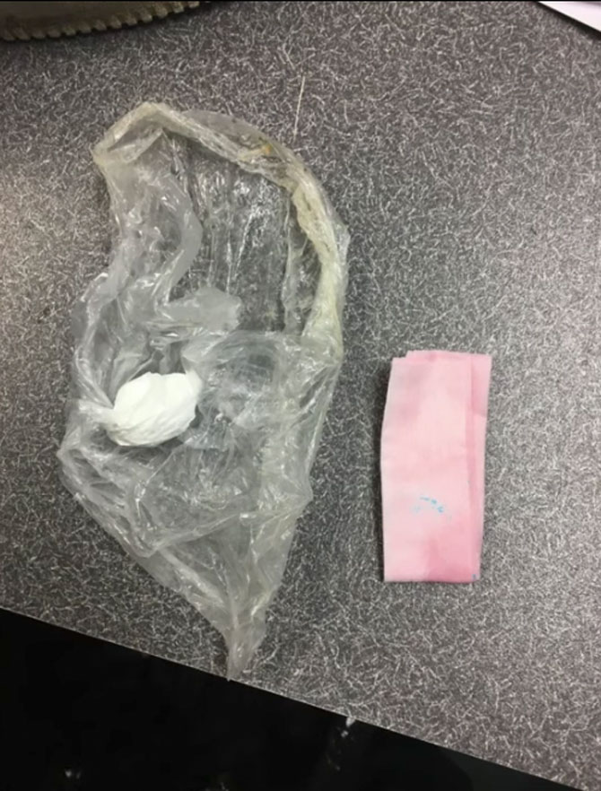 Cocaine baggie ingested by suspect (SOURCE: Round Lake Beach Police Department) Cocaine baggie ingested by suspect (SOURCE: Round Lake Beach Police Department)