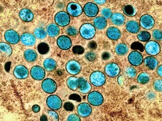 Colorized transmission electron micrograph of monkeypox particles (teal) found within an infected cell (brown), cultured in the laboratory. Image captured and color-enhanced at the NIAID Integrated Research Facility (IRF) in Fort Detrick, Maryland. Credit: NIAID (National Institute of Allergy and Infectious Diseases)