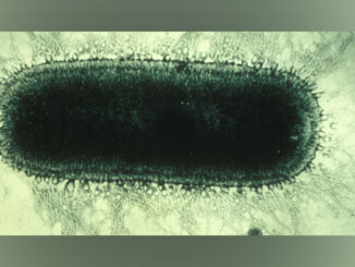 Electron Microscope image of Rabies Virus (SOURCE: Norden, a Smith-Kline Company, currently Glaxo Smith Kline or GSK, January 1, 1985)