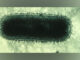 Electron Microscope image of Rabies Virus (SOURCE: Norden, a Smith-Kline Company, currently Glaxo Smith Kline or GSK, January 1, 1985)