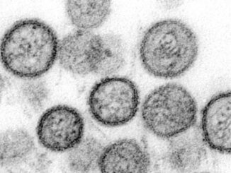 Sin Nombre strain of Hantavirus -- one of two types of strains (Andes, Sin Nombre) mentioned in this article (Public Domain/CDC)
