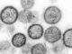 Sin Nombre strain of Hantavirus -- one of two types of strains (Andes, Sin Nombre) mentioned in this article (Public Domain/CDC)